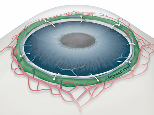Draining Eyes Clogged with Glaucoma 이미지