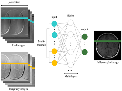 A Parallel MRI Method Accelerating Imaging Time Proposed 이미지
